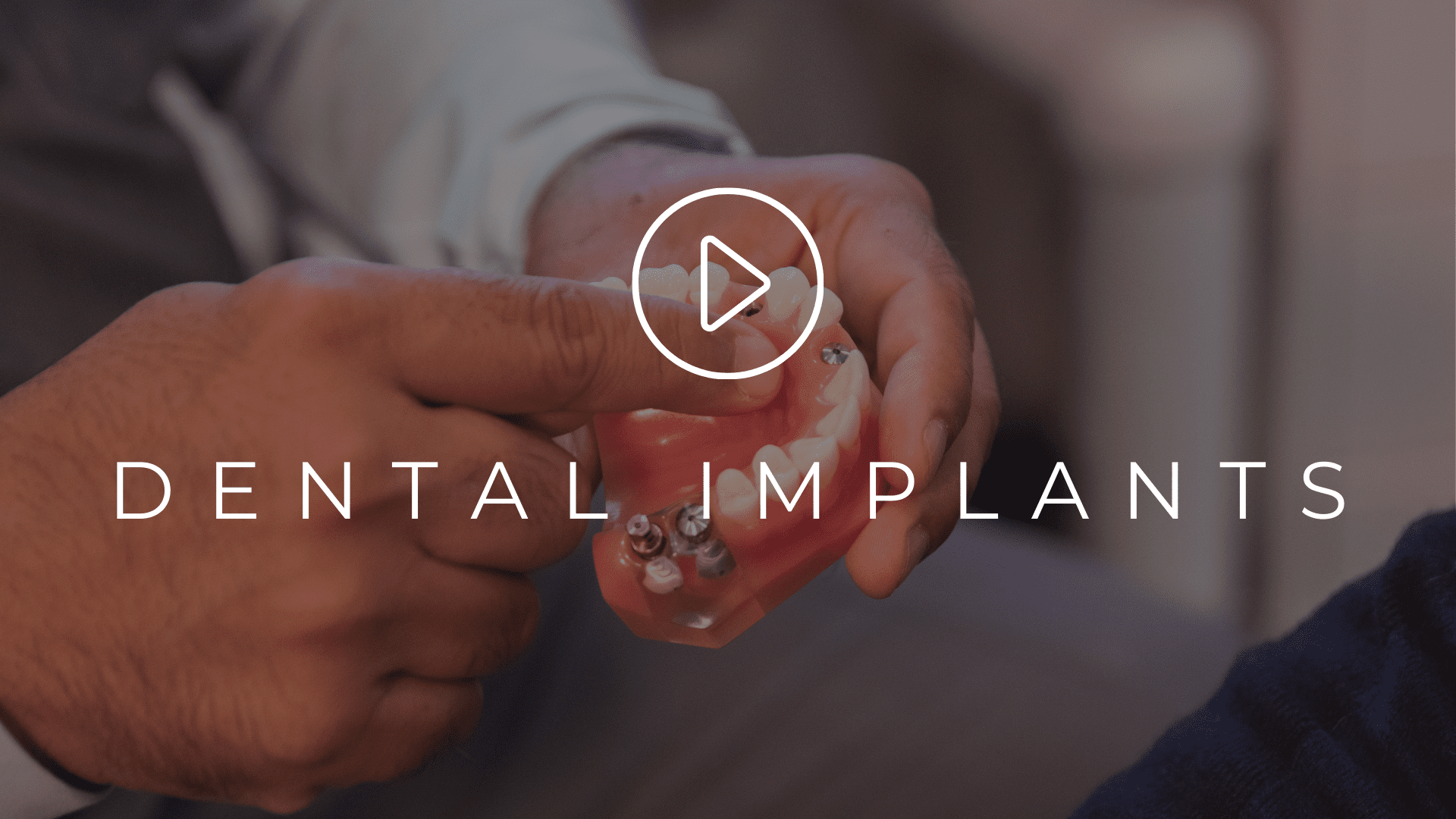 Dental Implants