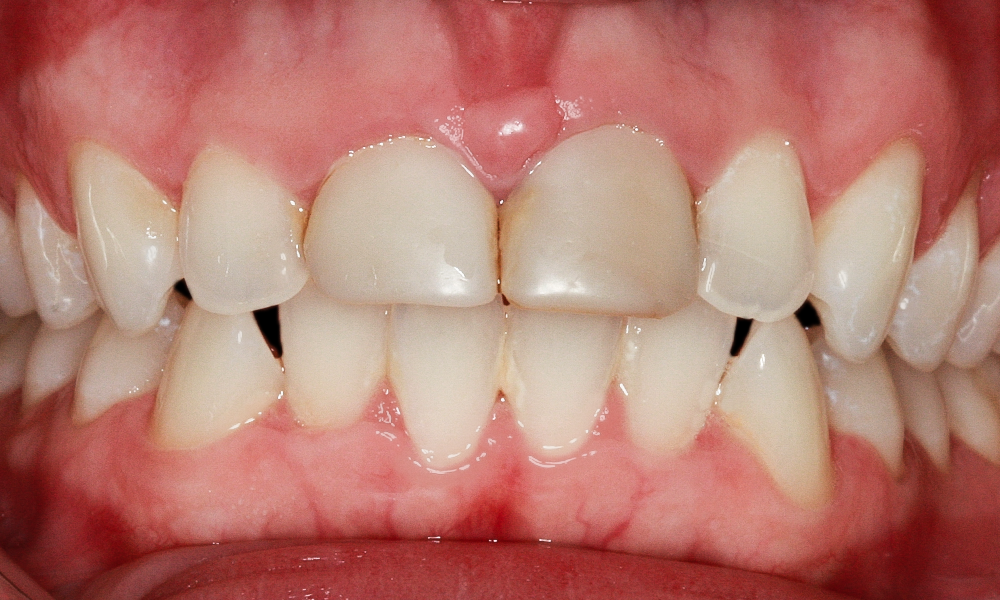 Case photo 1