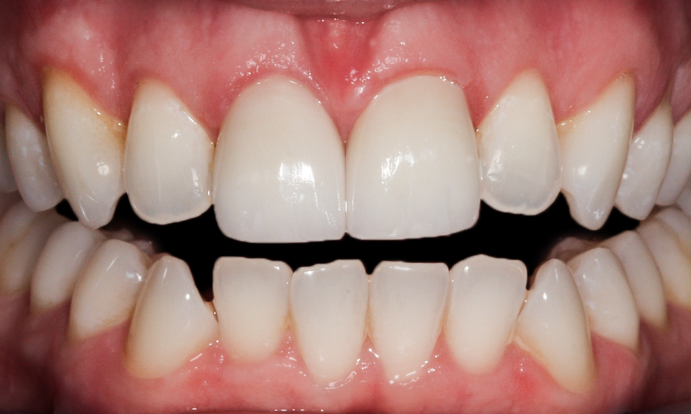Case photo 2