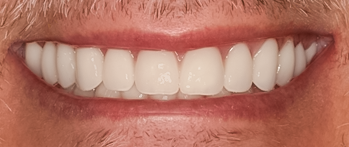 Case photo 3