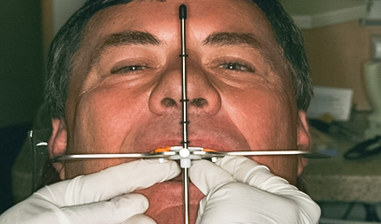After detail, Full Mouth Reconstruction, 51-YEAR-OLD Businessman