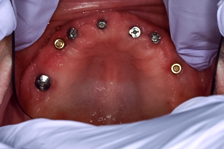 Case photo 1