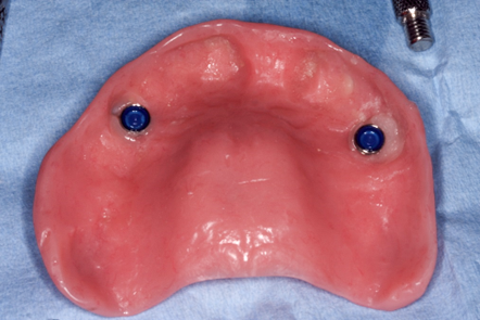 Case photo 2