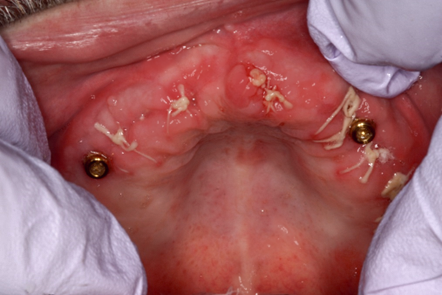 Case photo 3