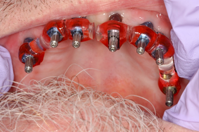 Case photo 5