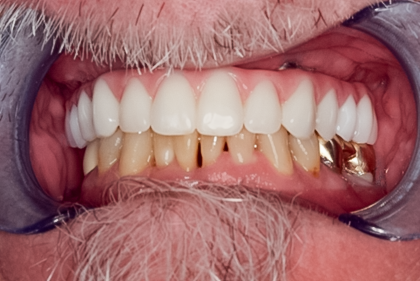 Case photo 9