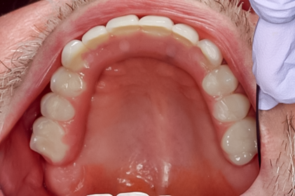 Case photo 10