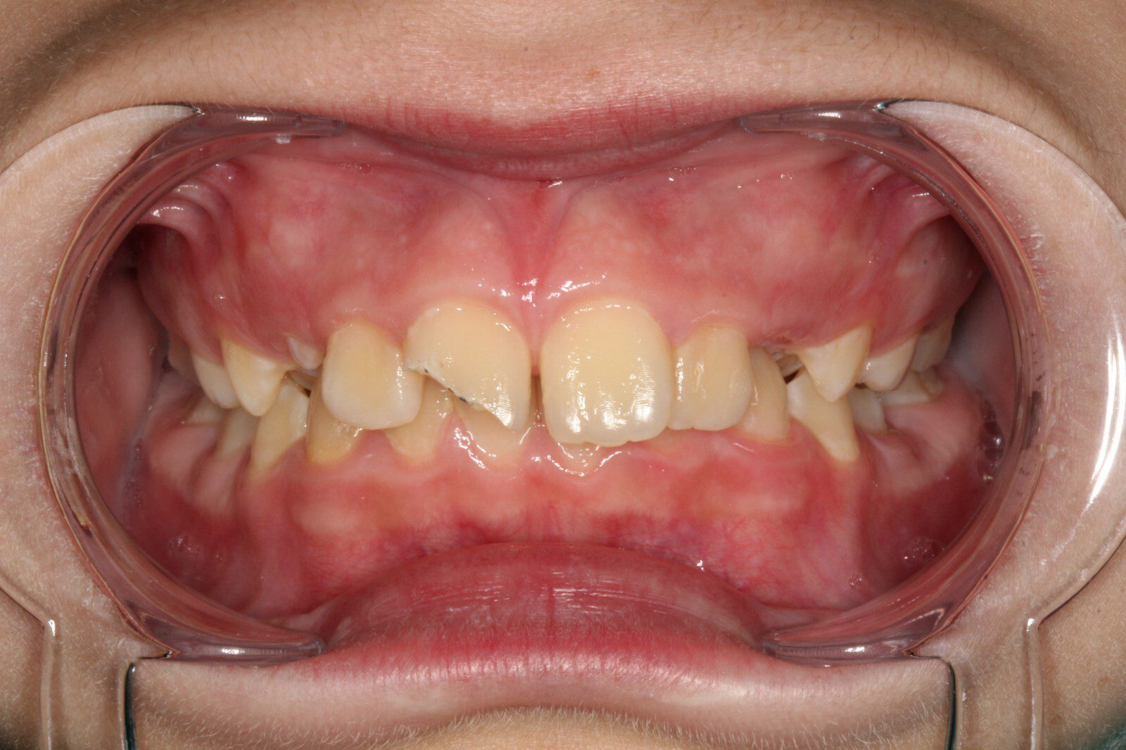 Case photo 2