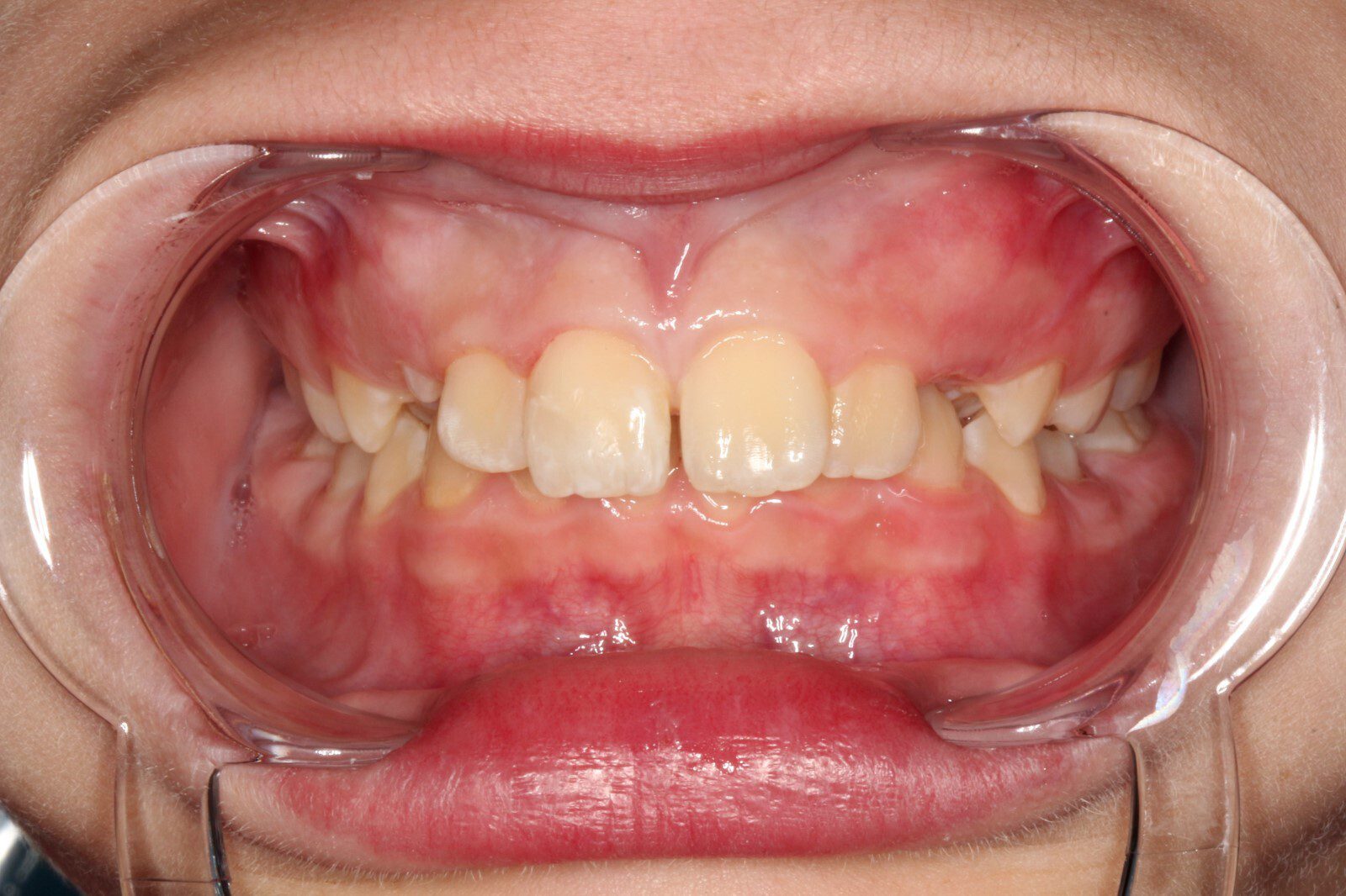 Case photo 1