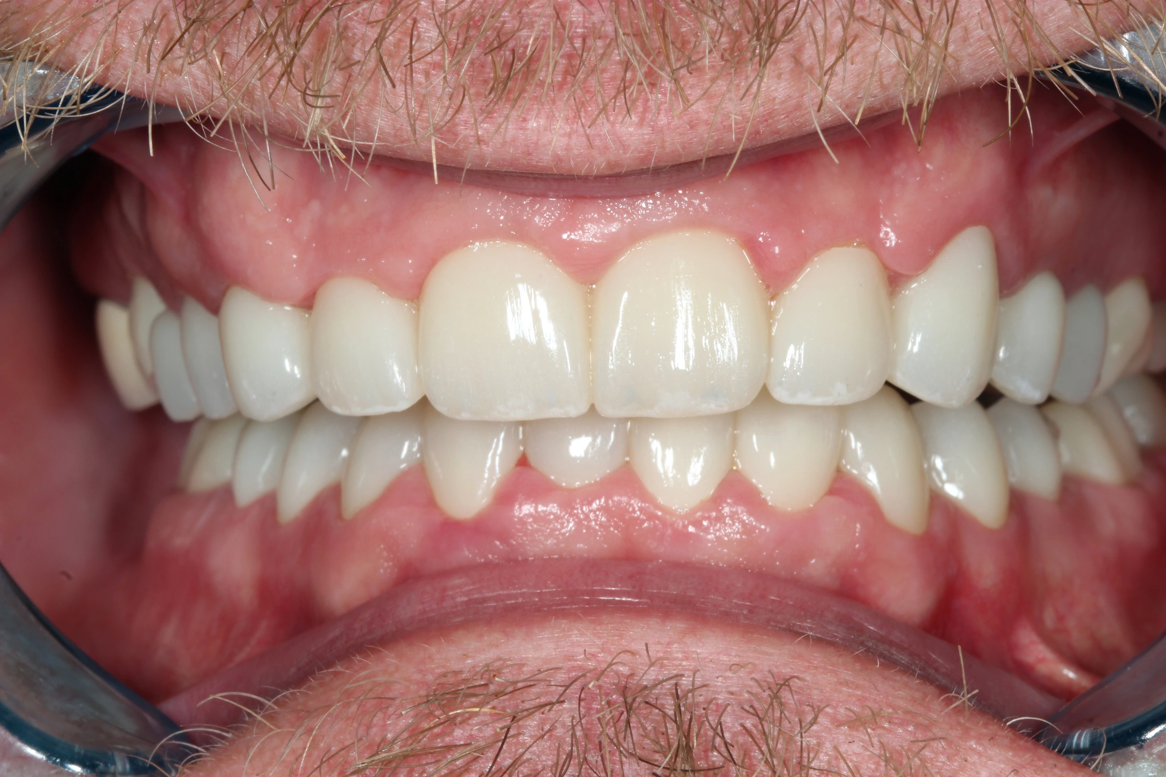 Stephen’s after-treatment photograph