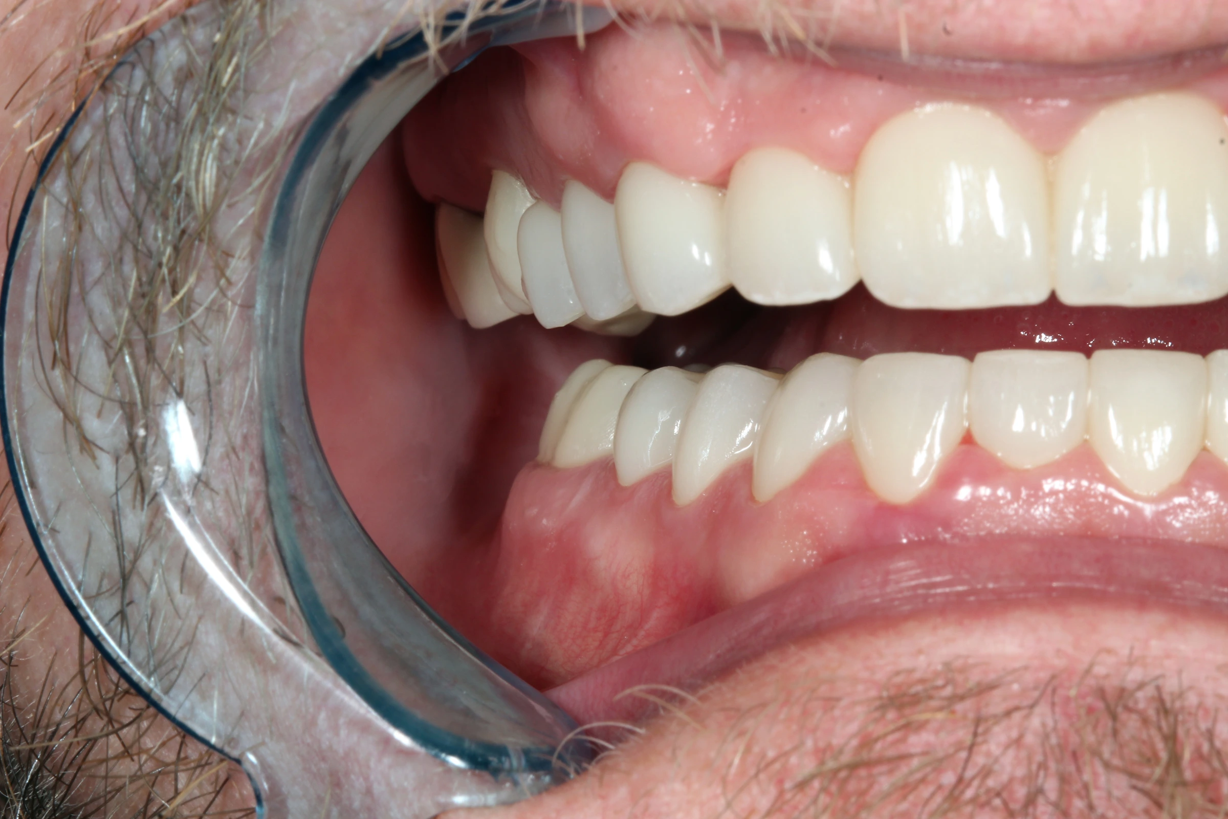 Stephen’s after-treatment photograph