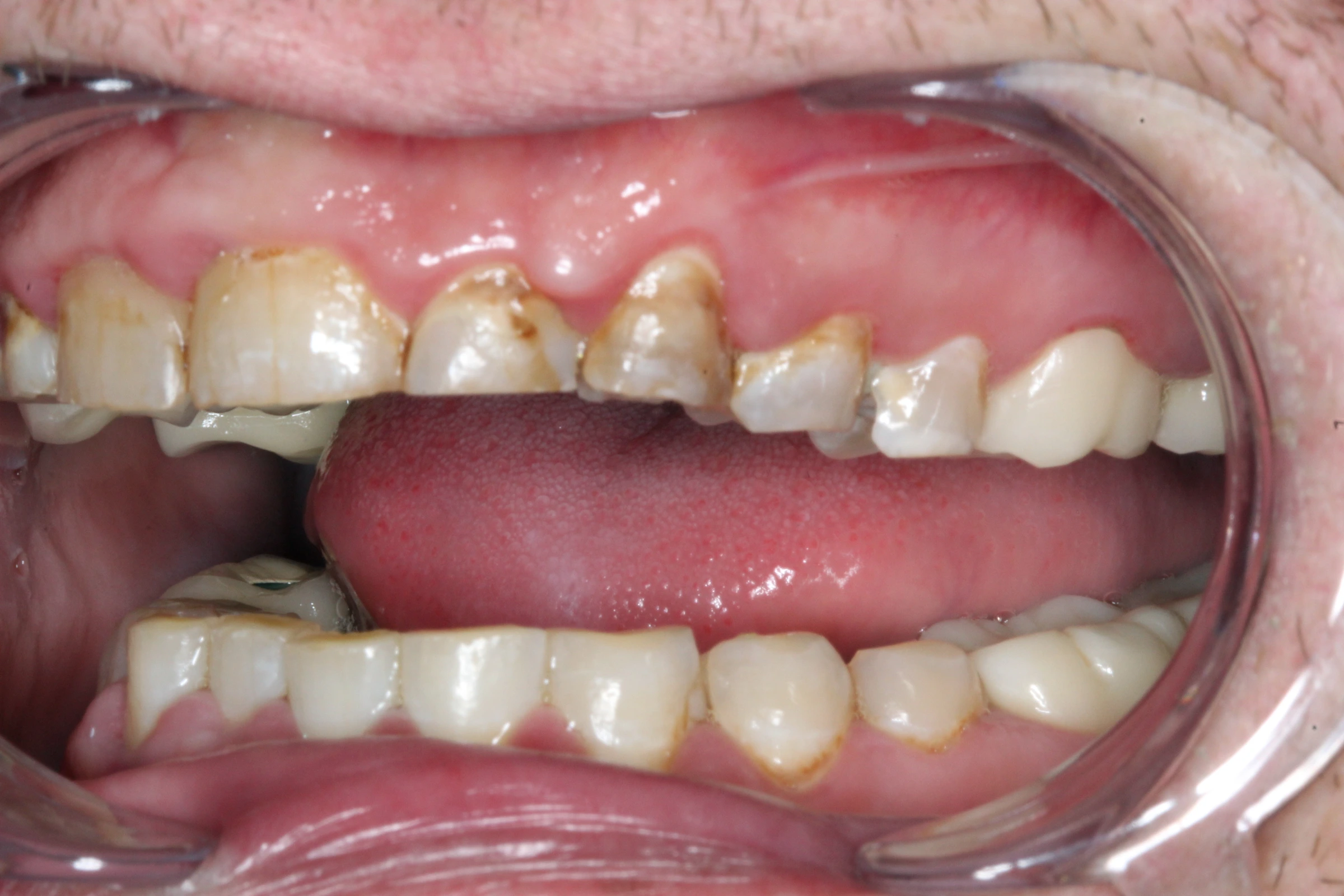 Stephen’s before-treatment photograph