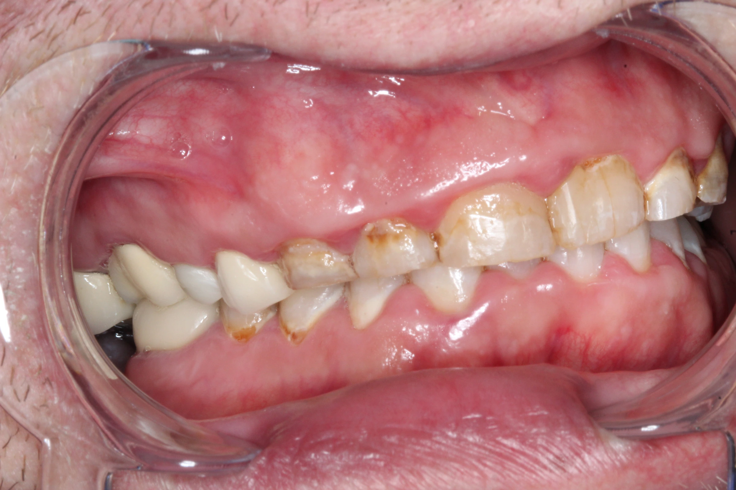 Stephen’s before-treatment photograph