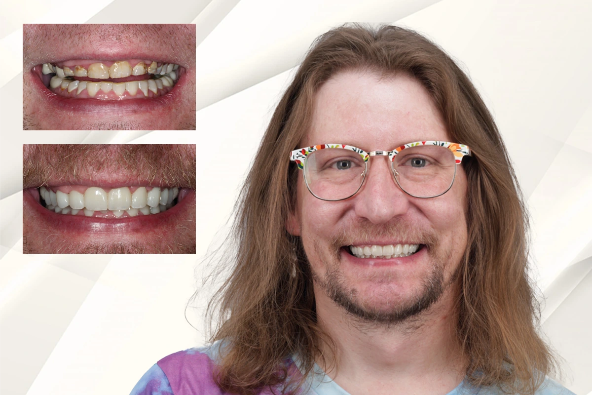 Stephen’s Smile Rehabilitation featured transformation