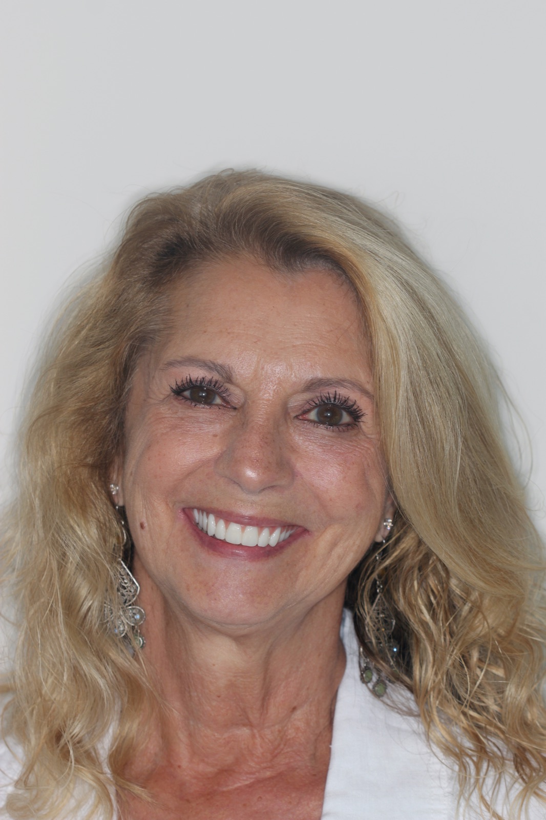 Portrait of Suzette after her All on 5 restoration