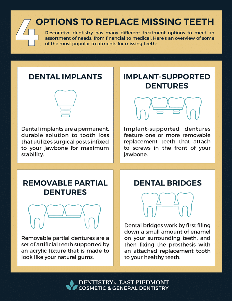 Replace Missing Front teeth with Tooth Colored filling, Implant or denture