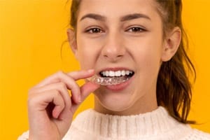 invisalign aligners use button attachments for crowded teeth