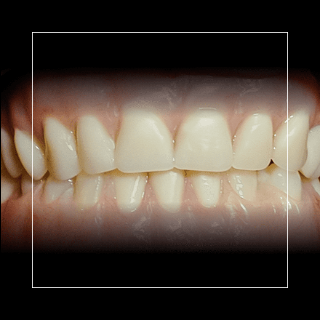 Dentures_ Modern Solutions for a Confident Smile