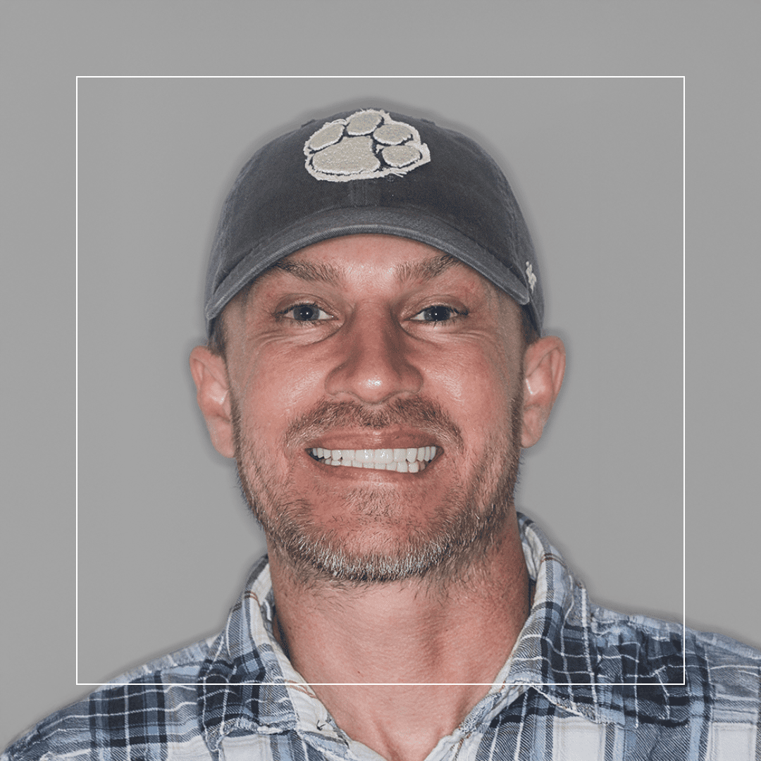 Josh – Full Upper and Lower TIAD _All on 6_ for a Permanent Smile Solution