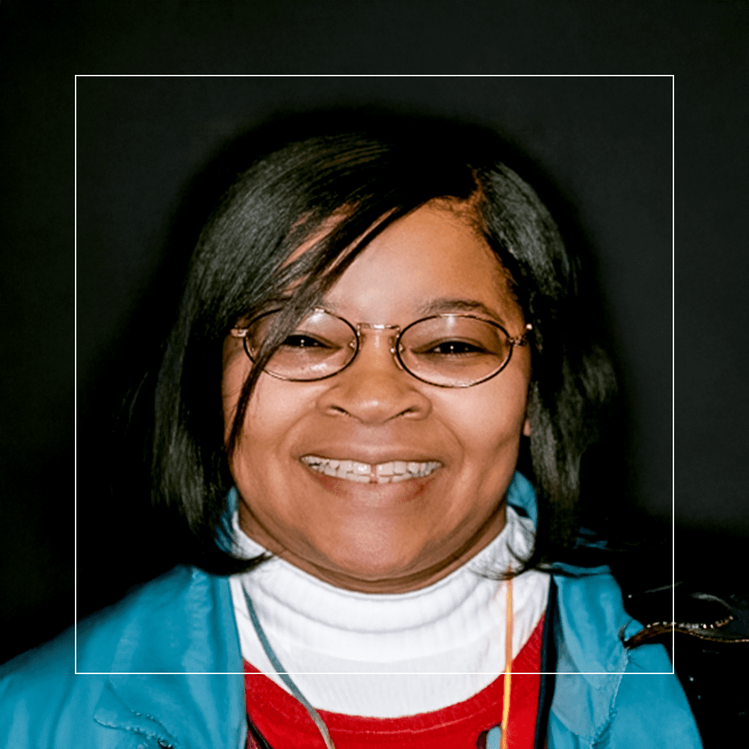 Partial Dentures – A Seamless Solution for Missing Teeth