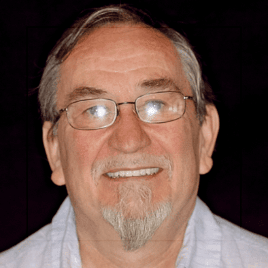 Ron – Full Upper Implant-Supported Denture