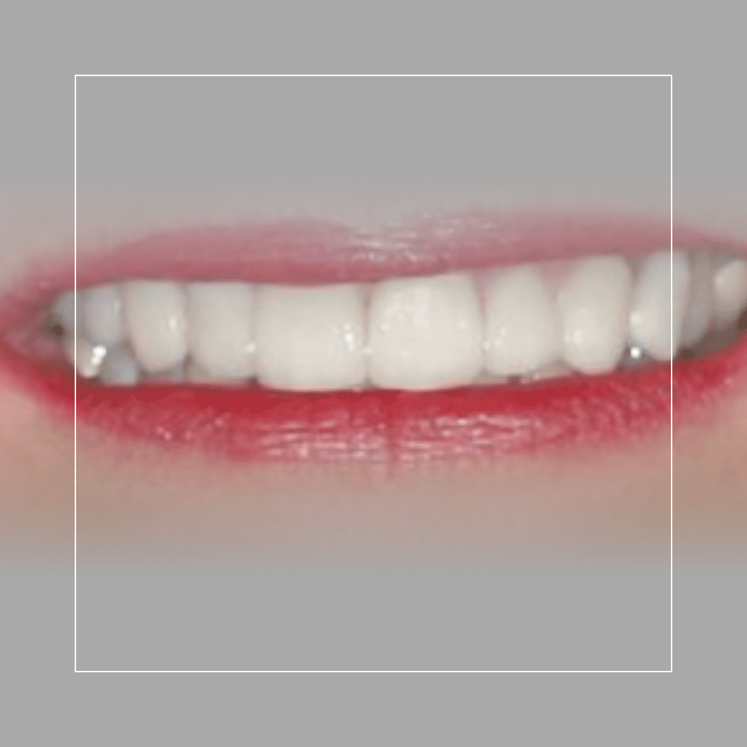 SMILEM~1