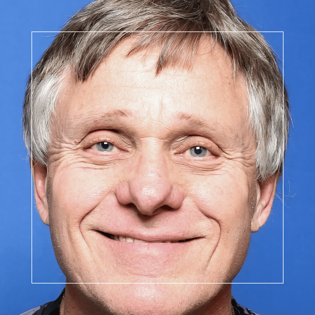 Teeth in a Day – Darrell